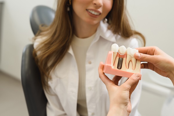 When Would You Need Dental Implants?