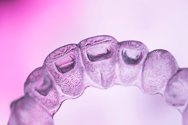 Keeping Teeth Straight After Clear Aligners Treatments from SmileWell Family Dentistry in Torrance, CA