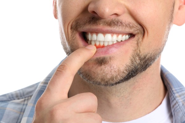 Preventive Tips To Avoid Gum Disease
