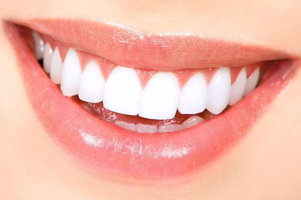 How Long Does Teeth Whitening Take from SmileWell Family Dentistry in Torrance, CA