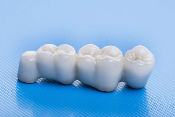 How Many Teeth Can Dental Bridges Replace from SmileWell Family Dentistry in Torrance, CA