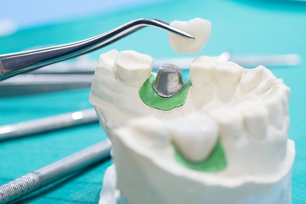 How Implant Crowns Can Restore Your Smile