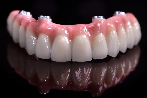 Implant Supported Dentures Torrance, CA