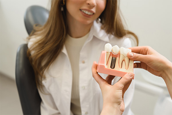 Options For Replacing Missing Teeth: Do I Have To Get Dental Implants?