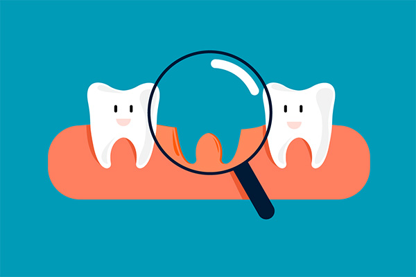 Options for Replacing Missing Teeth: What Treatments are Recommended? from SmileWell Family Dentistry in Torrance, CA