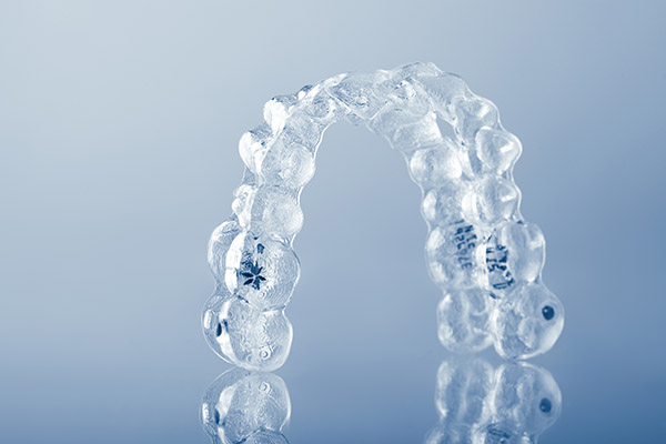 What Does The Clear Aligners Procedure Involve?